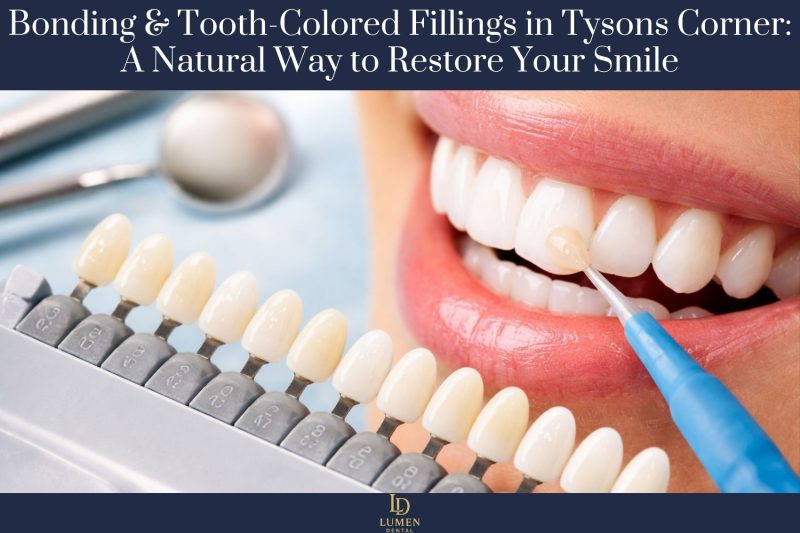 Bonding & Tooth-Colored Fillings in Tysons Corner: A Natural Way to Restore Your Smile