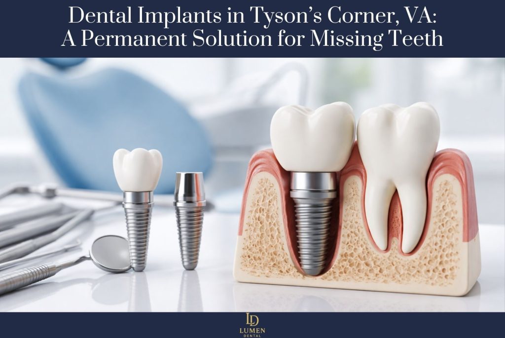 Dental Implants in Tyson’s Corner, VA A Permanent Solution for Missing Teeth