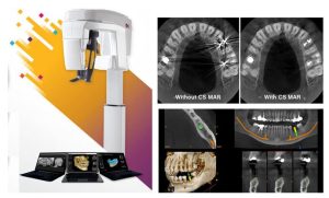3D dental scan Tysons Corner
