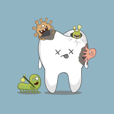 dental cavities tysons corner