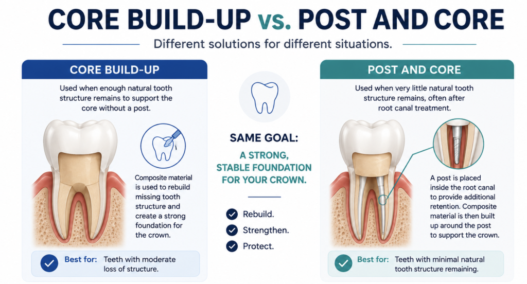 dental post and core Tysons Corner